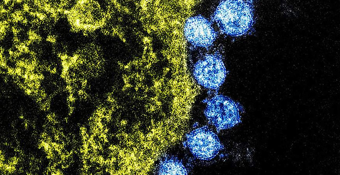 Novel coronavirus