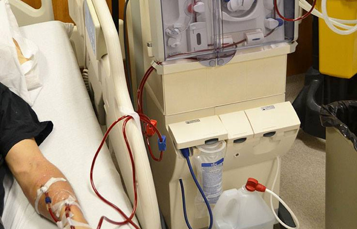 Dialysis services