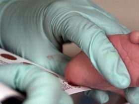 Newborn screening